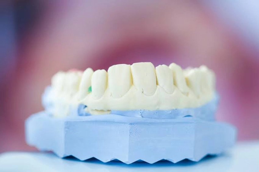 the healing clock when can i start using denture adhesive