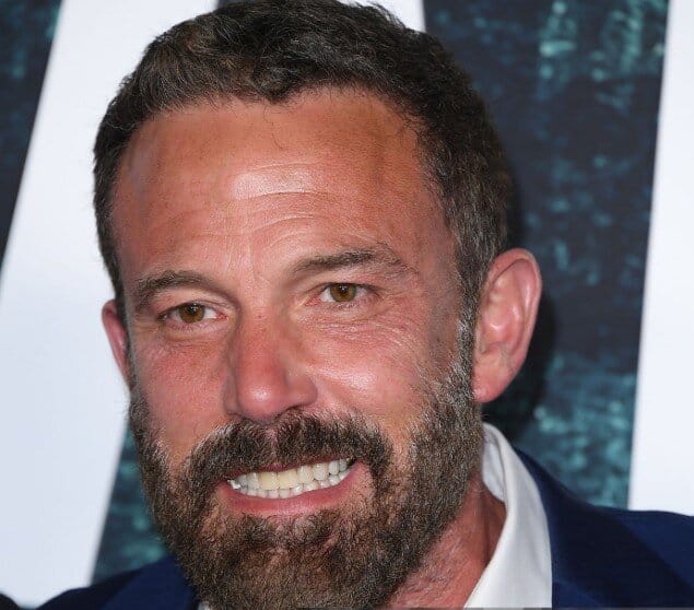ben affleck teeth in 2025