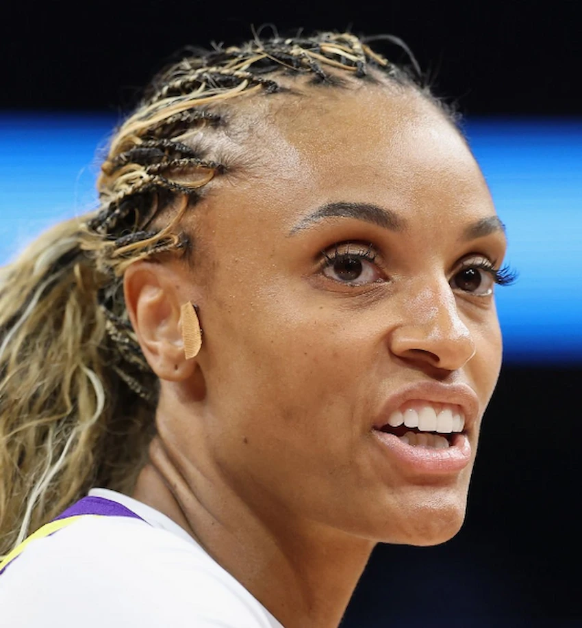 dewanna bonner teeth 2026