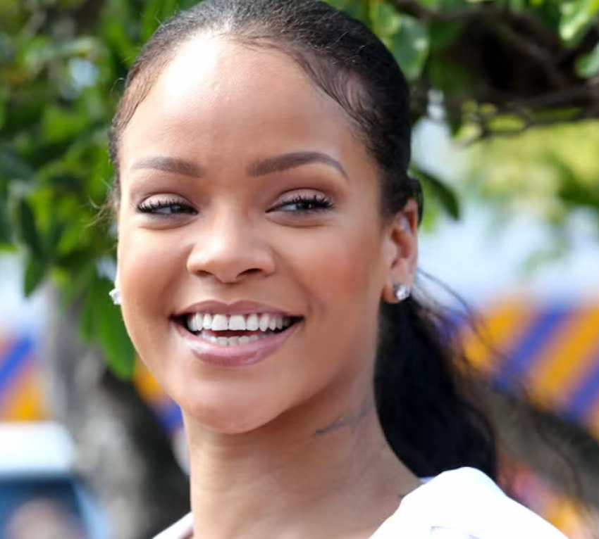 rihanna teeth before after