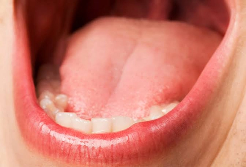 inside open mouth view tongue and teeth
