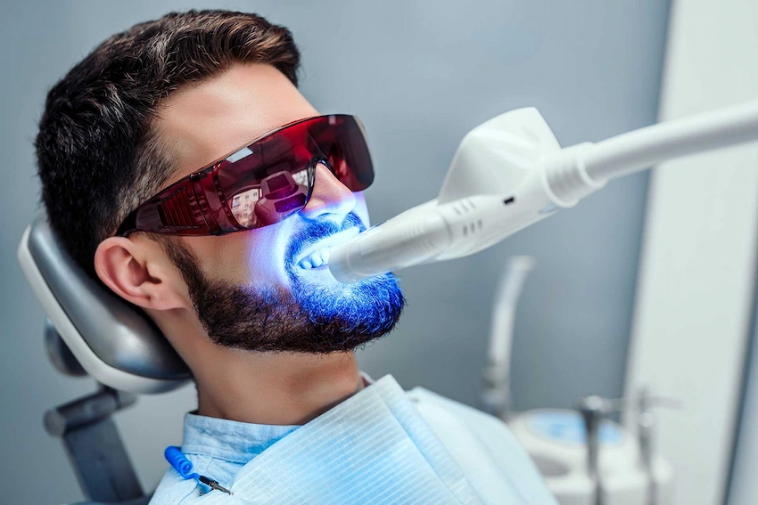 teeth whitening operation