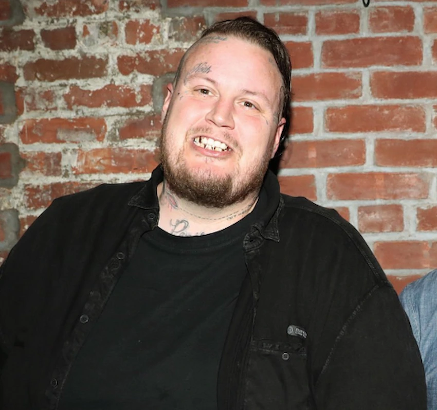 jelly roll teeth 2017