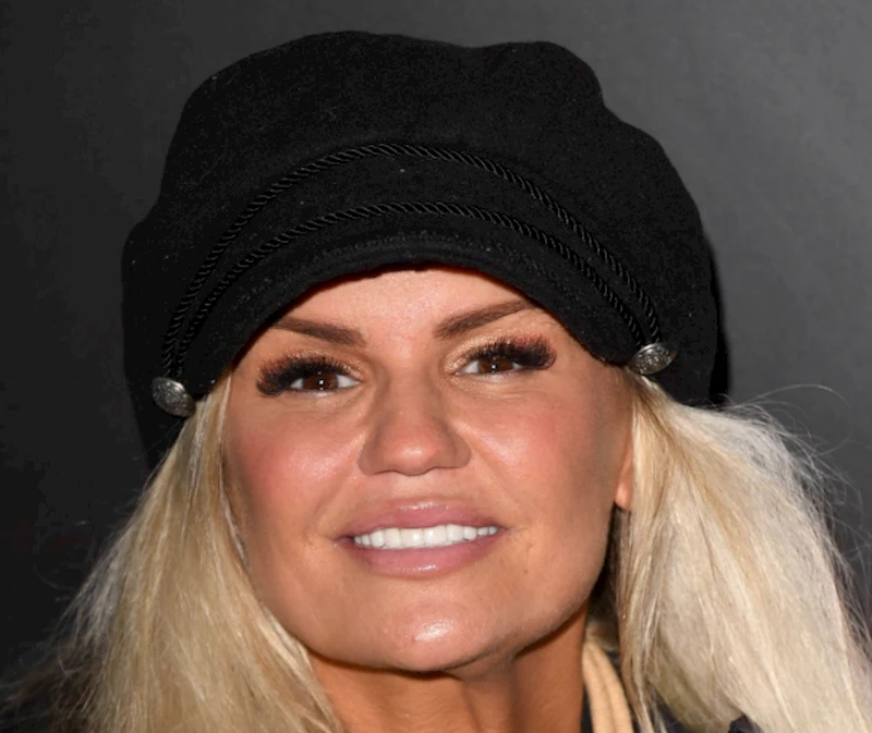 kerry katona teeth in 2020