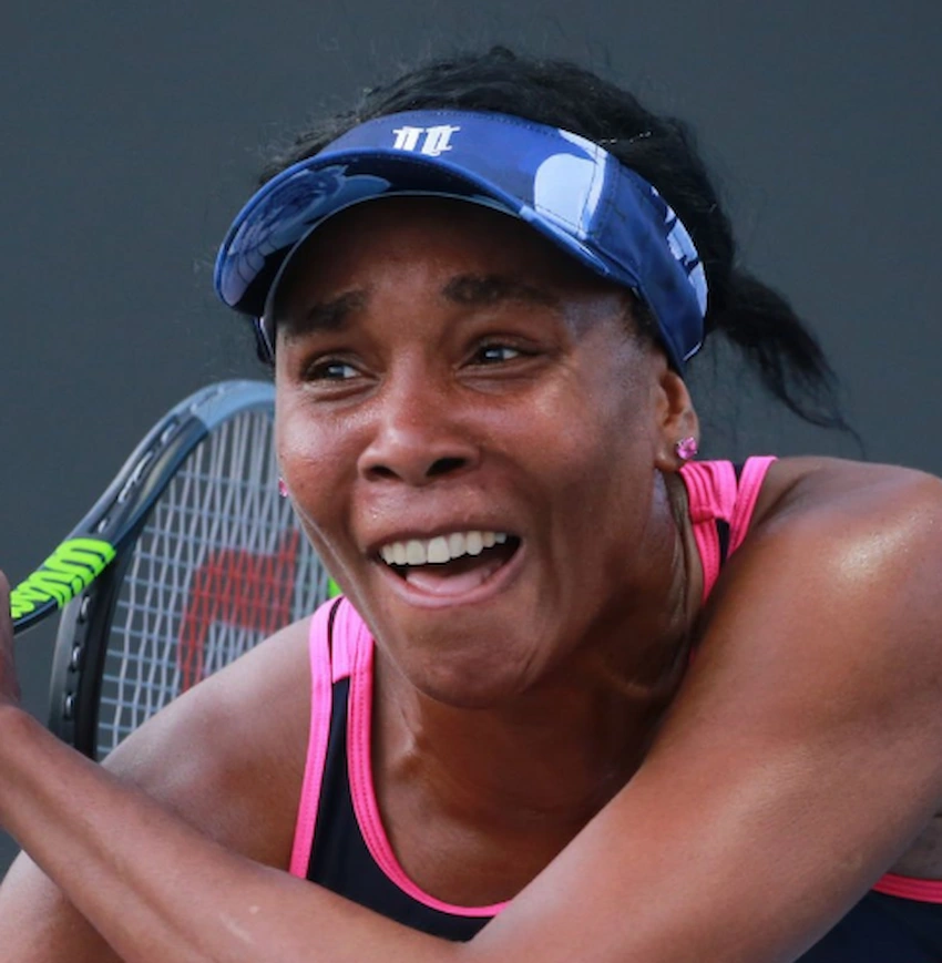 venus williams teeth 2020