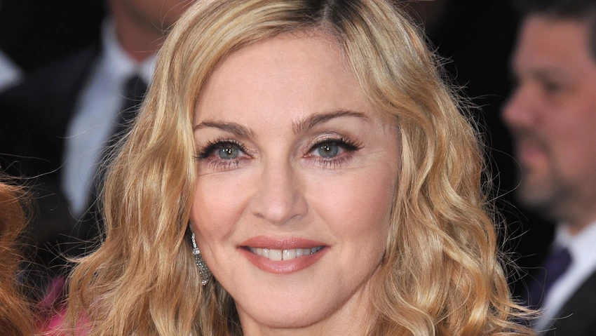 madonna teeth