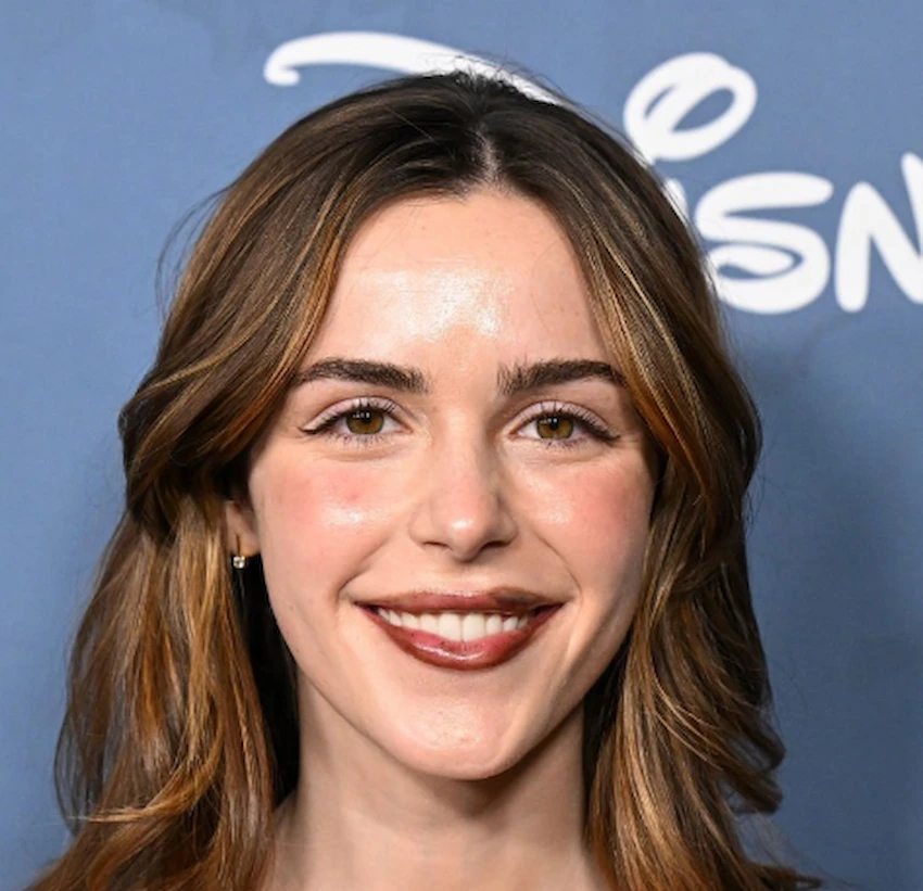 kiernan shipka teeth 2026