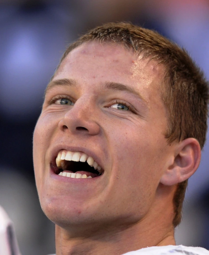 christian mccaffrey teeth 2013 christian mccaffrey teeth 2013