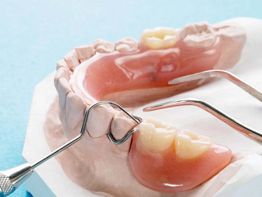 how to apply adhesive to partial dentures