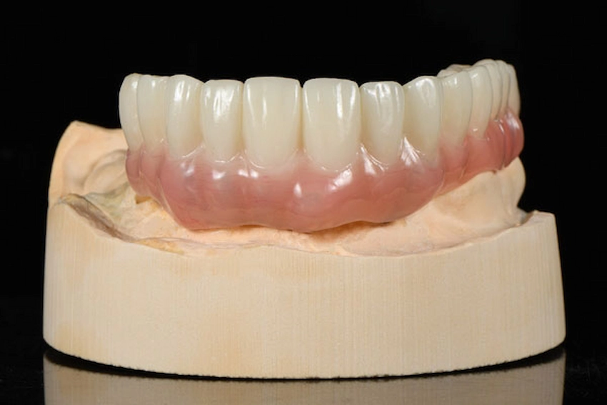 can i use denture adhesive for a temporary crown