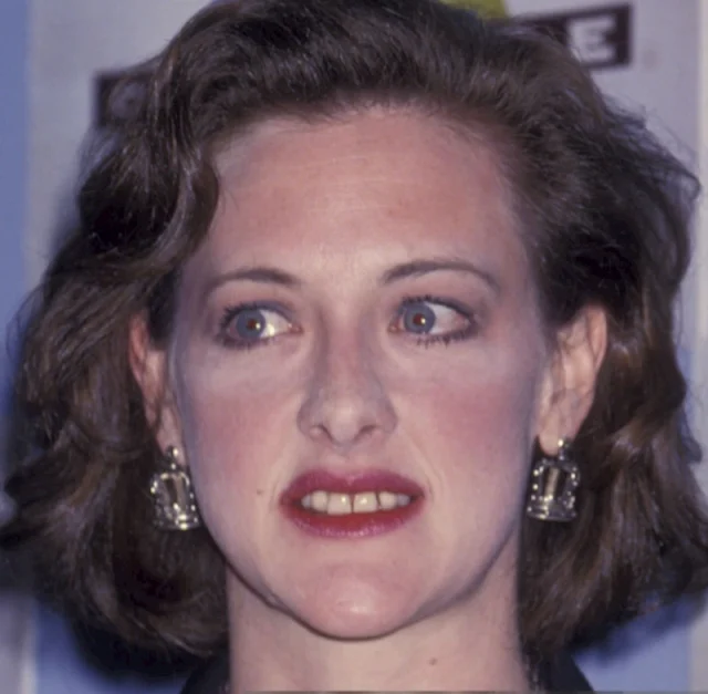 joan cusack teeth in 1990