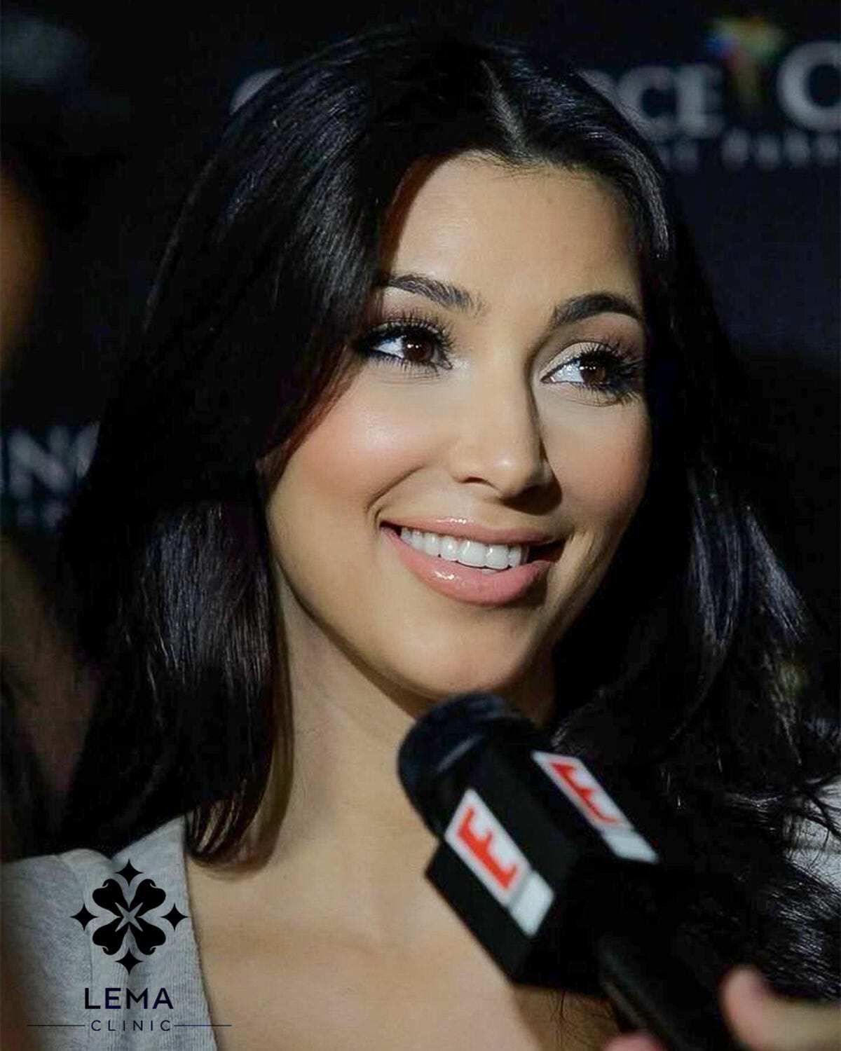 Kim Kardashian teeth