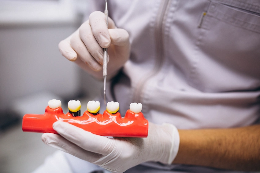 fixed implant bridge dental treatment
