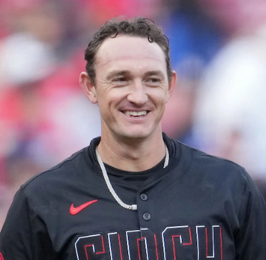 austin hays teeth 2025 austin hays teeth 2025