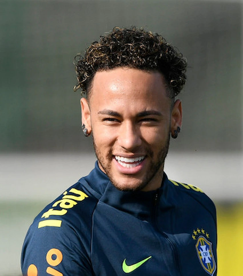 neymar teeth before after