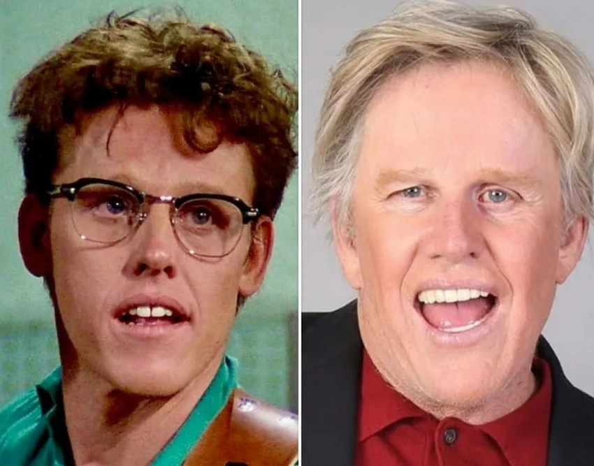 gary busey teeth before after