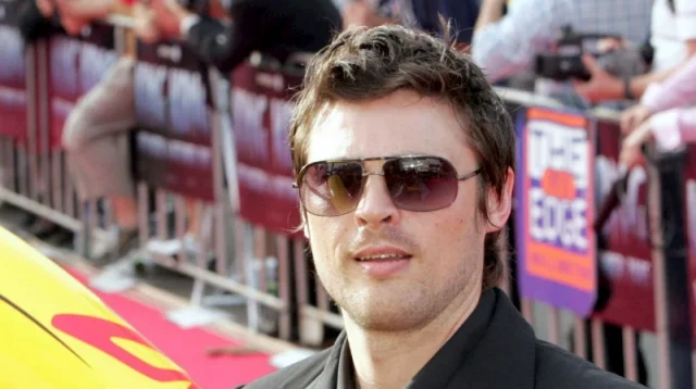 karl urban teeth in 2005 karl urban teeth in 2005