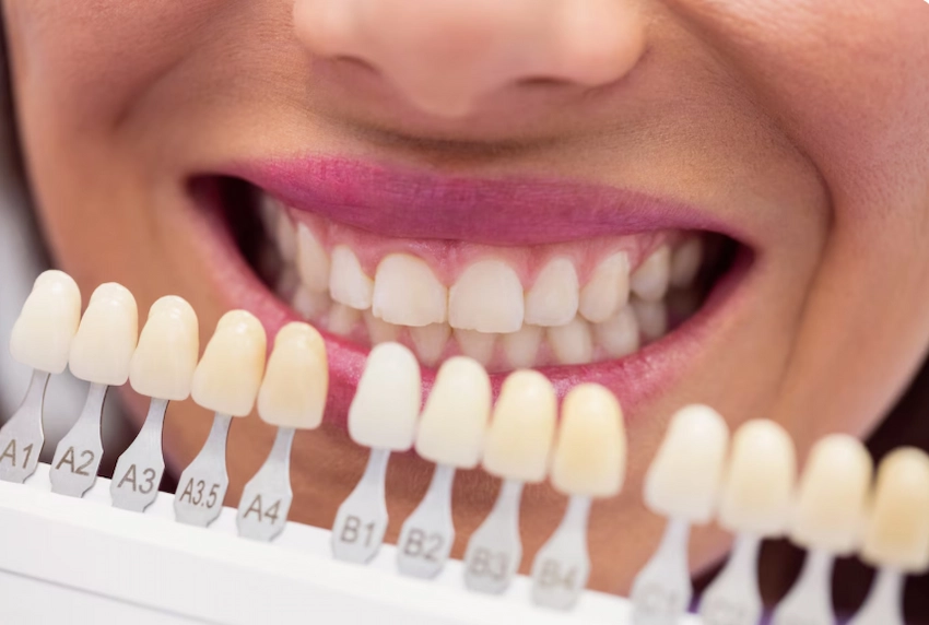 what teeth look the most natural