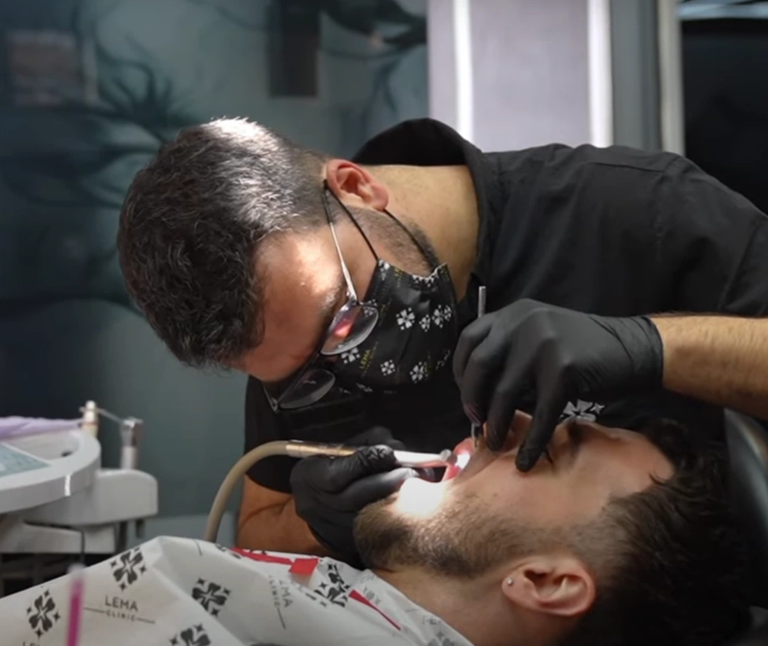 dental removal at lema dental clinic