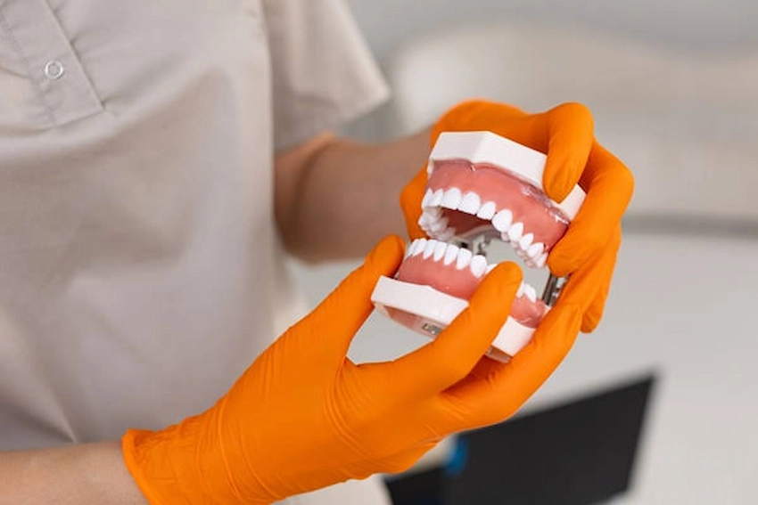 can i use denture adhesive with implants a clinical guide