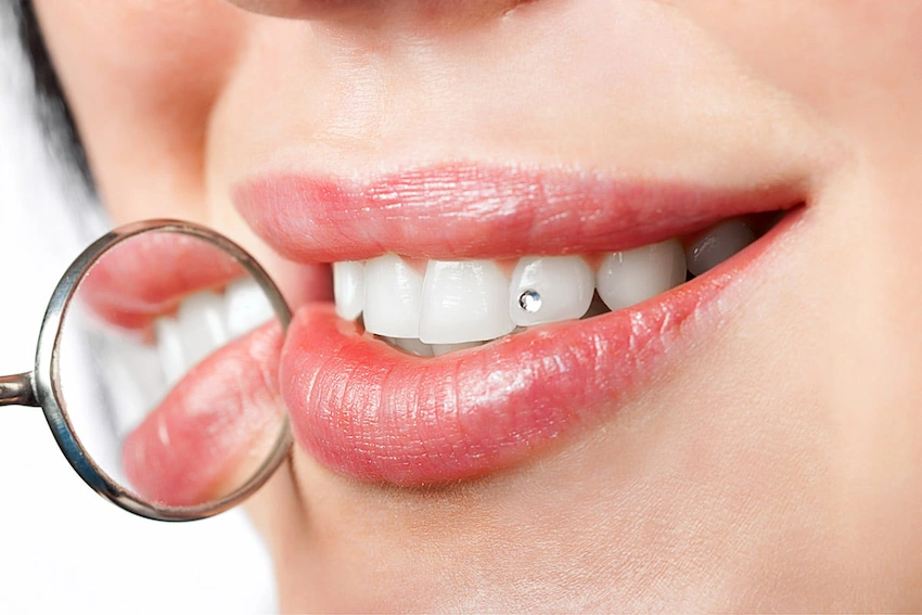 single diamond tooth gem professional removal