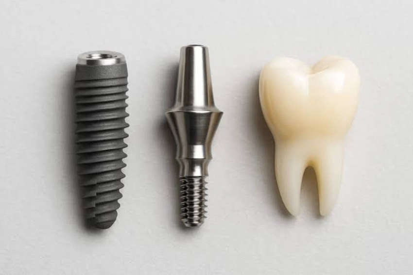 dental implant price range guide at lema dental clinic