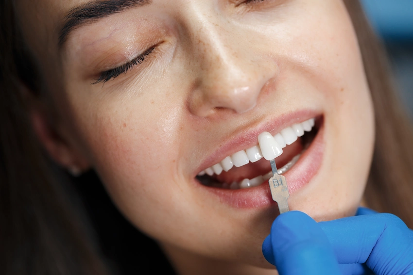dental restoration transformation old pfm dark gums to new zirconia crown