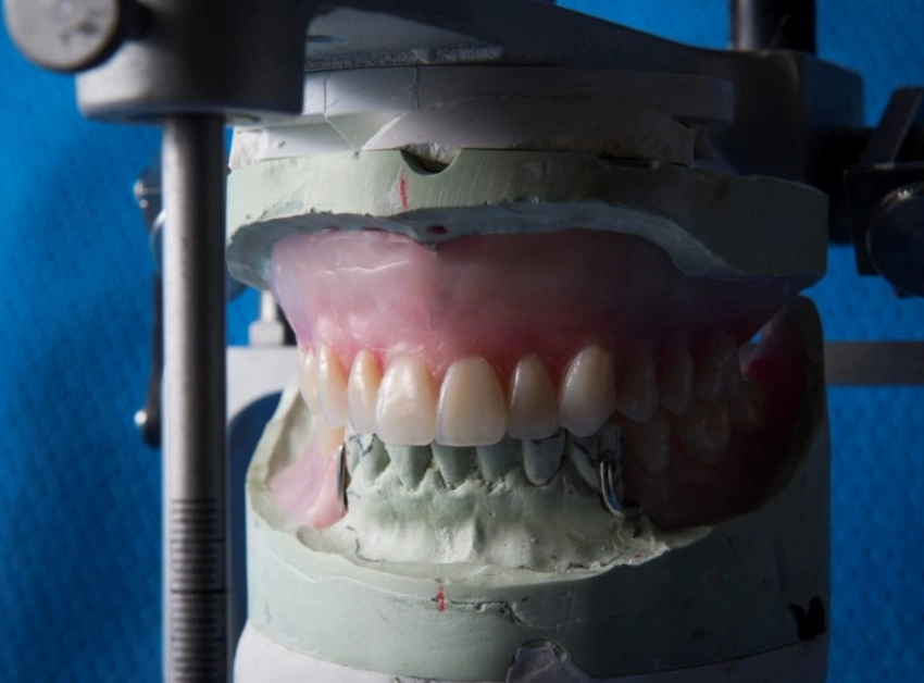 does dry mouth affect denture adhesive