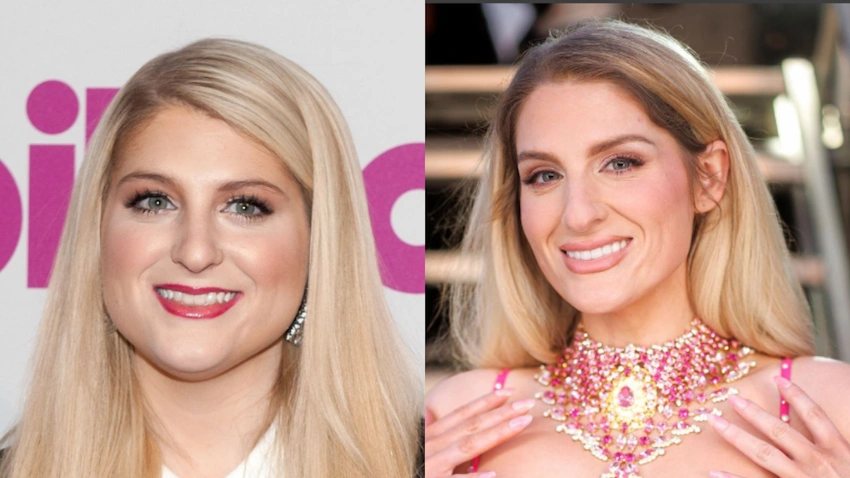 meghan trainor teeth before after