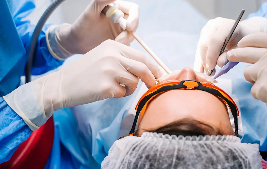 alveoloplasty oral surgery procedure