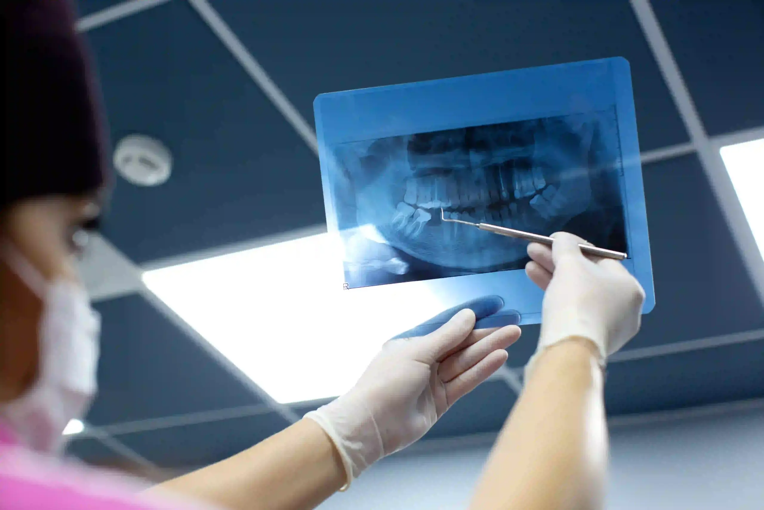 dentist checks x ray photo mouth