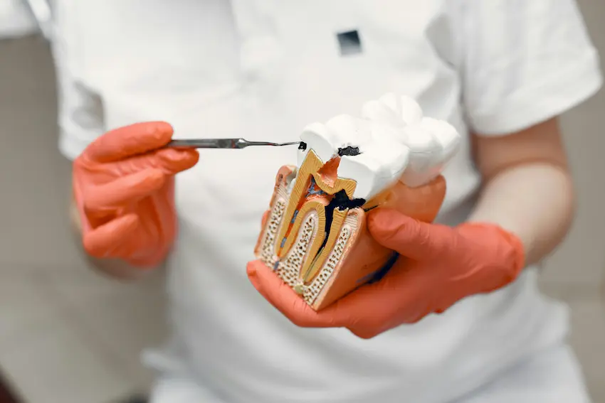 root canal bacteria