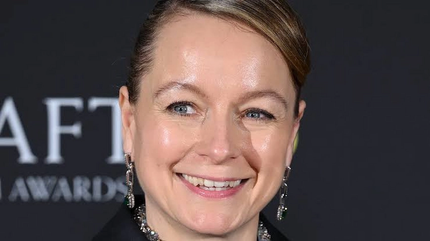 samantha morton teeth before after