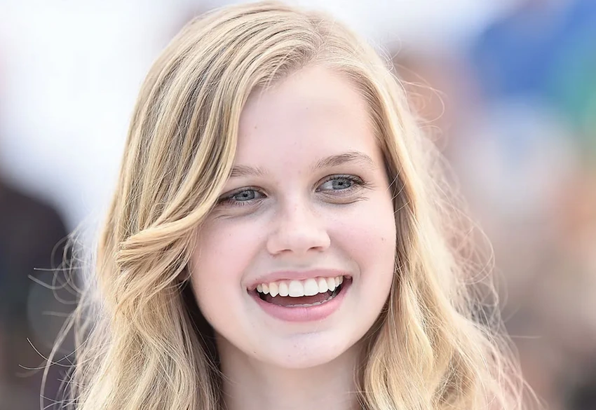 angourie rice teeth before after